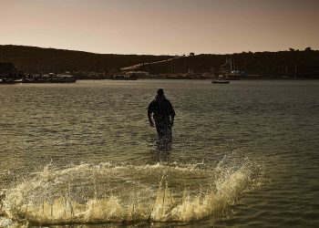 Ters Işıkta Lekeler Nasıl Değerlendirilir?