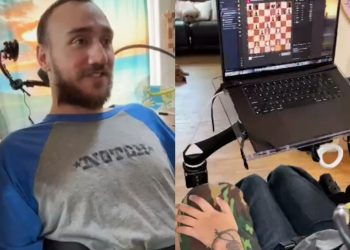 Neuralink'in Beynine Çip Taktığı Hasta Düşünerek Satranç Oynadı