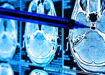 Avrupa Uzay Ajansı Uyduyu Kasıtlı Olarak Yakacak