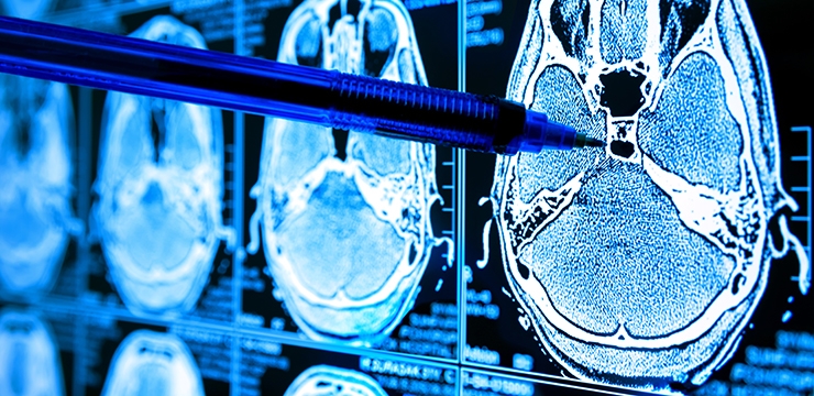 Avrupa Uzay Ajansı Uyduyu Kasıtlı Olarak Yakacak