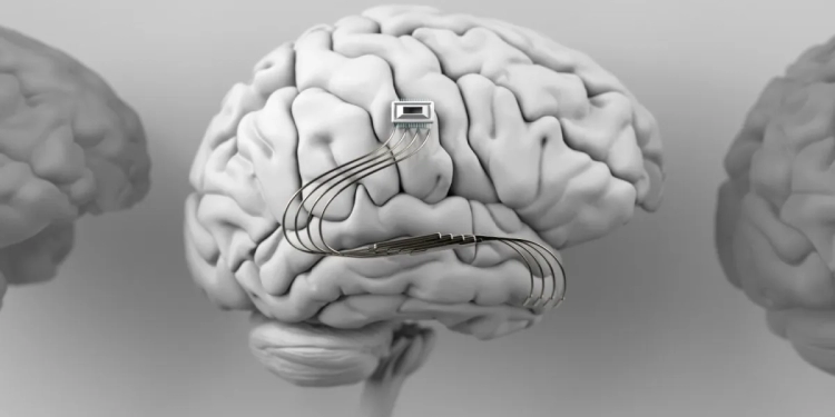 Bilim Kurgu Gerçek Oldu: Beyin İmplantı İç Sesinizi Okuyabiliyor